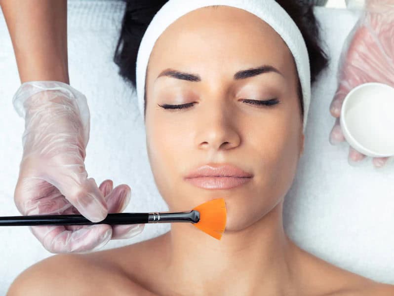 chemical peels